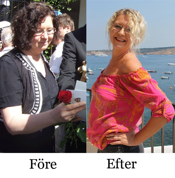 Anna Åberg före och efter