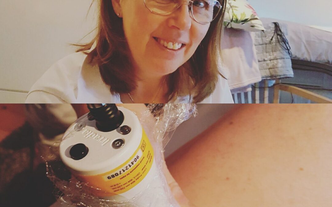 Laser en suverän behandlingsmetod